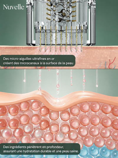 Nuvelle Facial Microinfusion